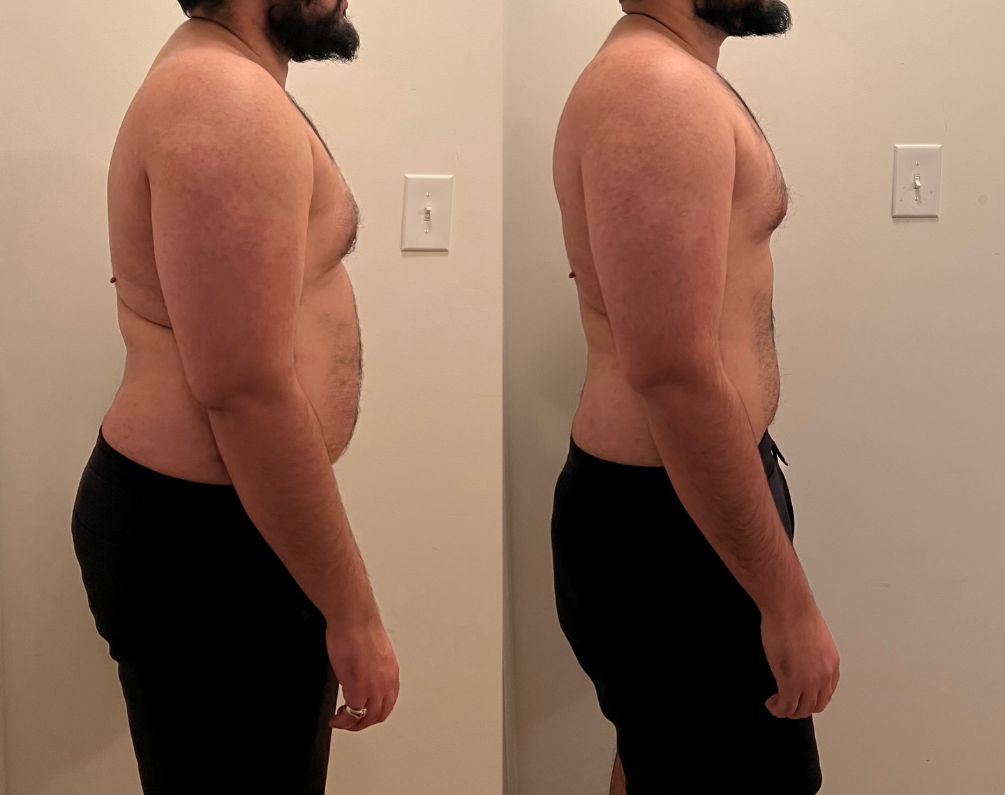 Male client side profile before and after fat loss